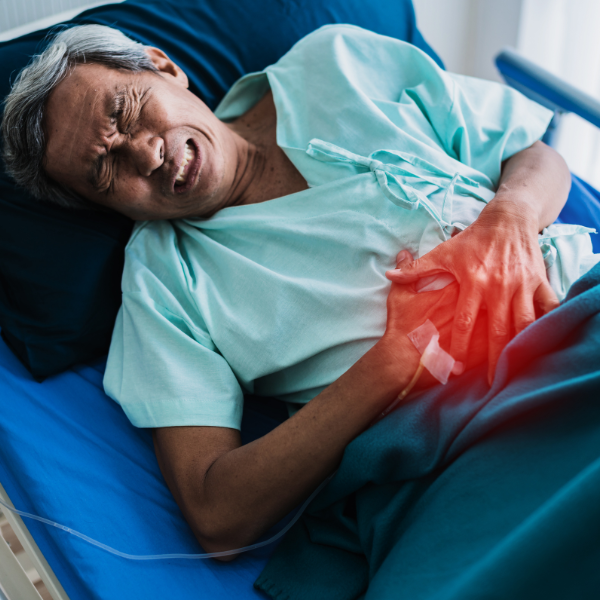 Renal Replacement Therapy